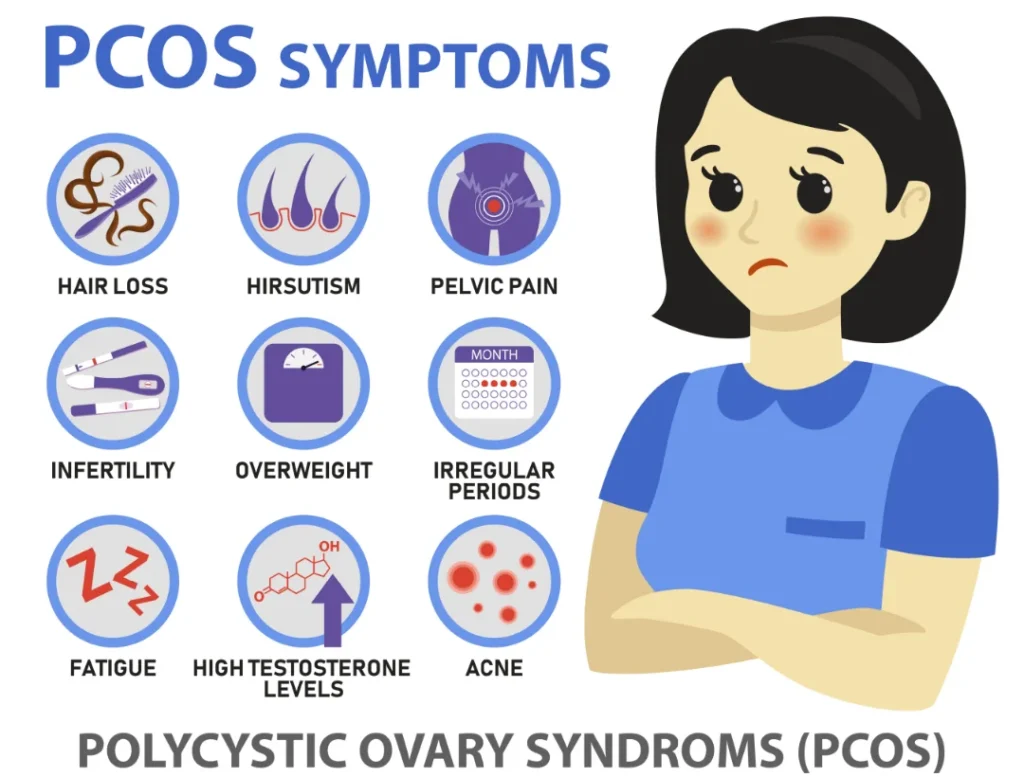 diagram related to symptopms of PCOS