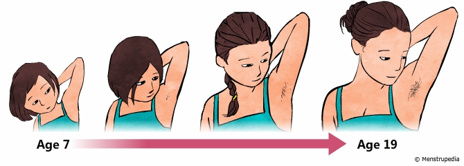 Image showing the development of axillary (underarm) hair in girls during puberty, highlighting this typical physical change.