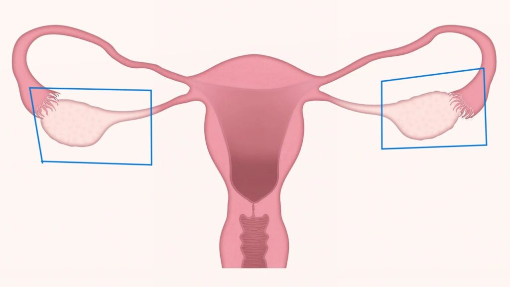 ovarian insufficiency casues menopause