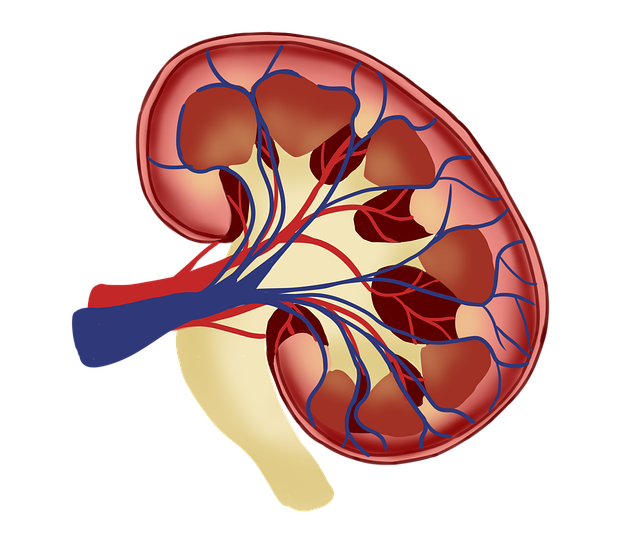 kidney (polycystic kidney disease)